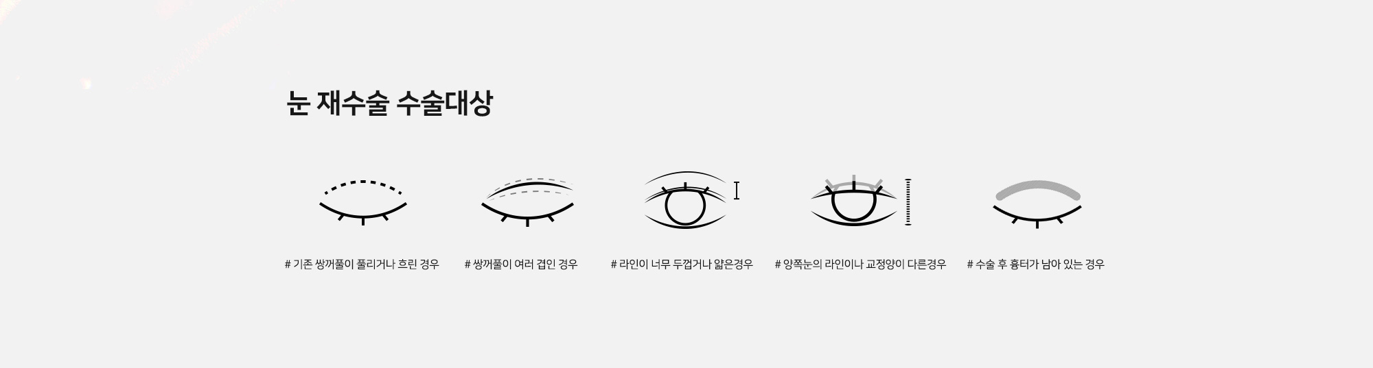 [눈 재수술 수술대상] # 기존 쌍꺼풀이 풀리거나 흐린 경우 # 쌍꺼풀이 여러 겹인 경우 # 라인이 너무 두껍거나 얇은경우 # 양쪽눈의 라인이나 교정양이 다른경우 # 수술 후 흉터가 남아 있는 경우