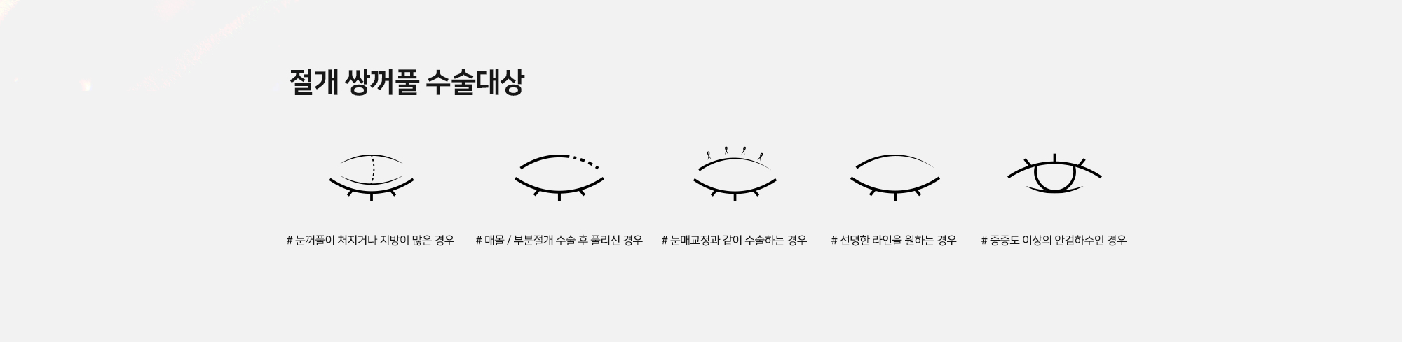 절개 쌍꺼풀 수술대상 - # 눈꺼풀이 처지거나 지방이 많은 경우 # 매몰 / 부분절개 수술 후 풀리신 경우 # 눈매교정과 같이 수술하는 경우 # 선명한 라인을 원하는 경우 # 중증도 이상의 안검하수인 경우