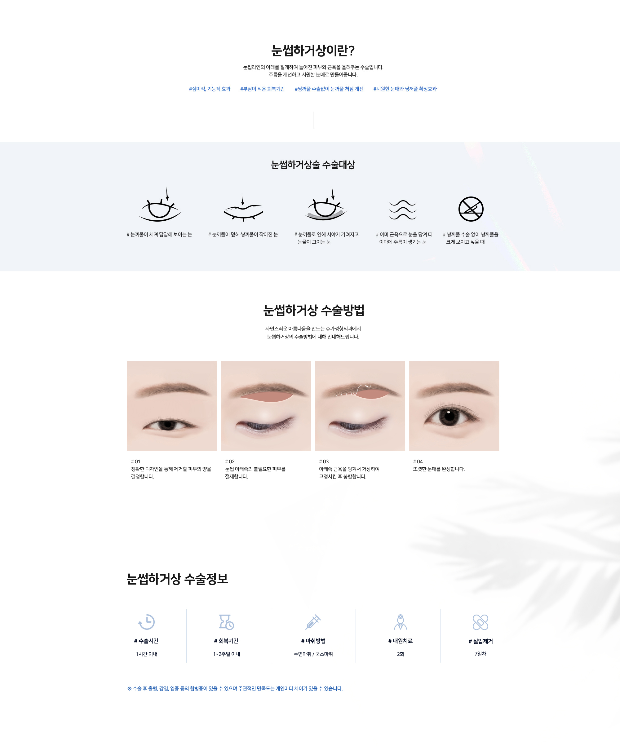 #subbrow lift