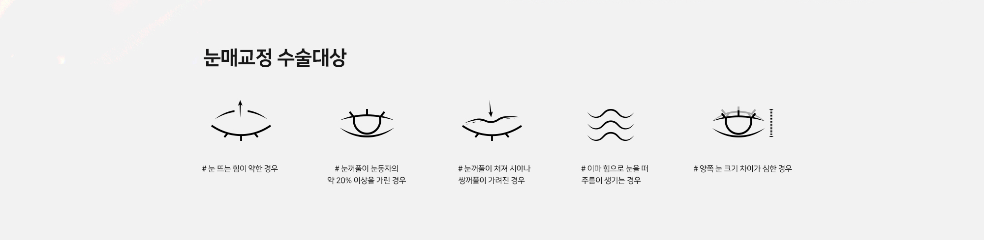 눈매교정 수술대상 - # 눈 뜨는 힘이 약한 경우 # 눈꺼풀이 눈동자의 약 20% 이상을 가린 경우 # 눈꺼풀이 처져 시야나 쌍꺼풀이 가려진 경우 # 이마 힘으로 눈을 떠 주름이 생기는 경우 # 양쪽 눈 크기 차이가 심한 경우