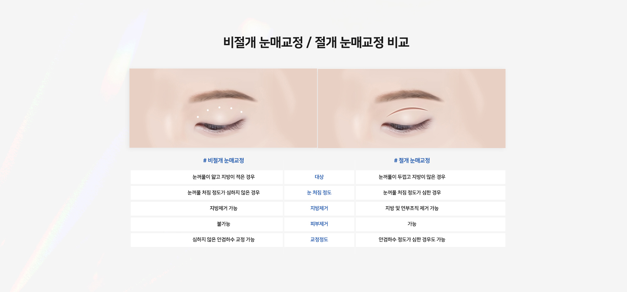 비절개 눈매교정 / 절개 눈매교정 비교 - # 비절개 눈매교정: 눈꺼풀이 얇고 지방이 적은 경우 / 눈꺼풀 처짐 정도가 심하지 않은 경우 / 지방제거 가능 / 피부제거 불가능 / 심하지 않은 안검하수 교정 가능. # 절개 눈매교정: 눈꺼풀이 두껍고 지방이 많은 경우 / 눈꺼풀 처짐 정도가 심한 경우 / 지방 및 연부조직 제거 가능 / 피부제거 가능 / 안검하수 정도가 심한 경우도 가능. (대상 / 눈 처짐 정도 / 지방제거 / 피부제거 / 교정정도)