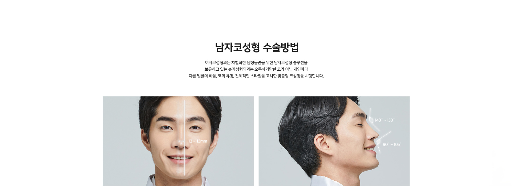 [남자코성형 수술방법] 여자코성형과는 차별화한 남성들만을 위한 남자코성형 솔루션을 보유하고 있는 슈가성형외과는 오뚝하게만 높이는 코가 아닌 개인마다 다른 얼굴의 비율, 코의 유형, 전체적인 스타일을 고려한 맞춤형 코성형을 시행합니다.
