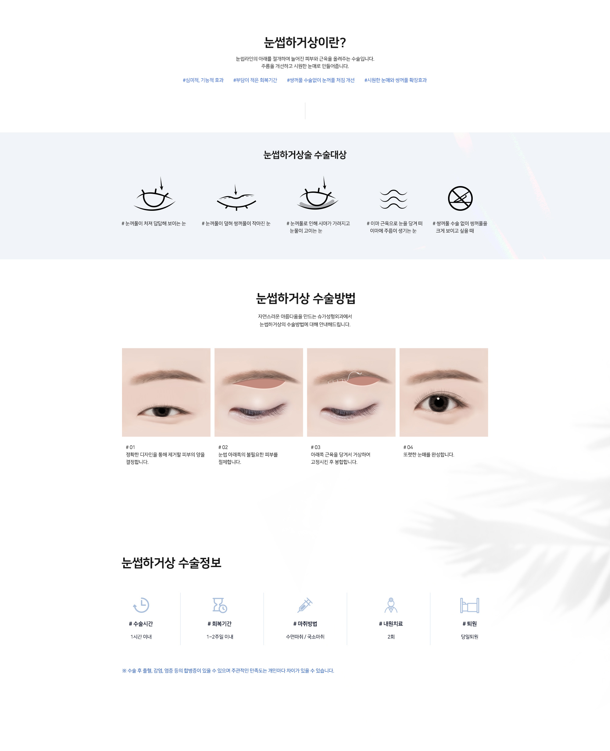 [눈썹하거상] #심미적, 기능적 효과 #부담이 적은 회복기간 #쌍꺼풀 수술없이 눈꺼풀 처짐 개선 #시원한 눈매와 쌍꺼풀 확장효과 눈썹라인의 아래를 절개하여 늘어진 피부와 근육을 올려주는 수술입니다. 주름을 개선하고 시원한 눈매로 만들어줍니다.
