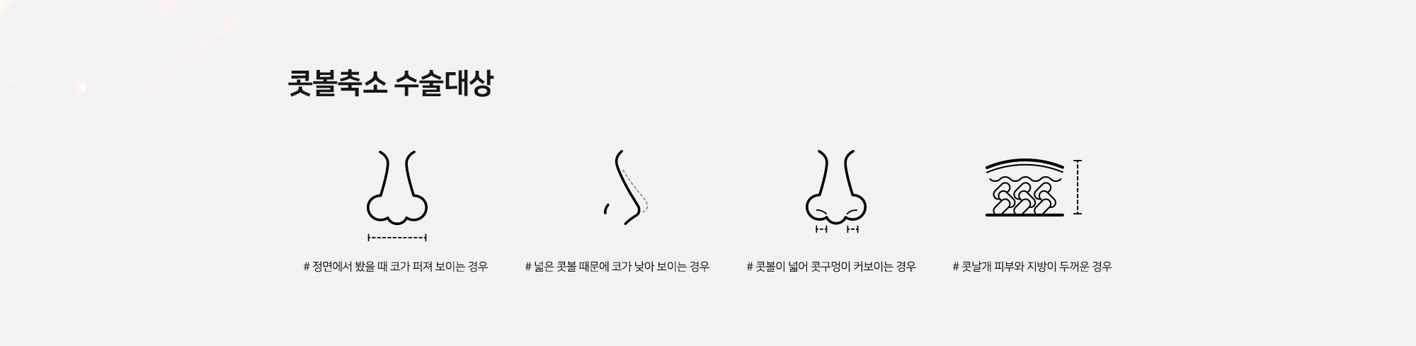 콧볼축소 수술대상 # 정면에서 봤을 때 코가 퍼져 보이는 경우 # 넓은 콧볼 때문에 코가 낮아 보이는 경우 # 콧볼이 넓어 콧구멍이 커보이는 경우 # 콧날개 피부와 지방이 두꺼운 경우