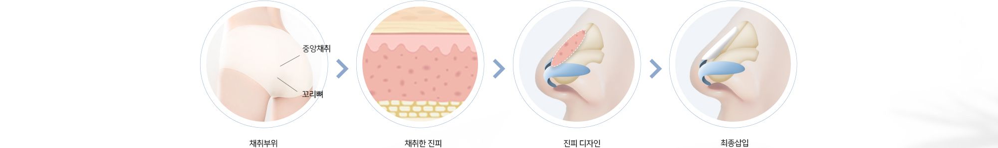 채취부위 (중앙채취, 꼬리뼈) > 채취한 진피 > 진피 디자인 > 최종삽입