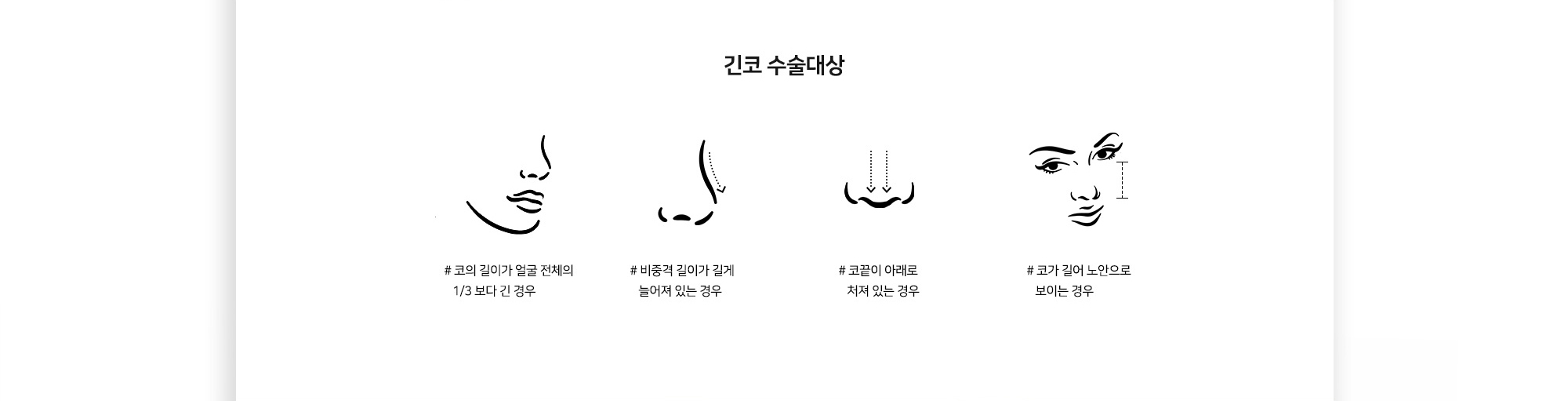 긴코 수술대상 # 코의 길이가 얼굴 전체의 1/3보다 긴 경우 # 비중격 길이가 길게 늘어져 있는 경우 # 코끝이 아래로 처져 있는 경우 # 코가 길어 노안으로 보이는 경우