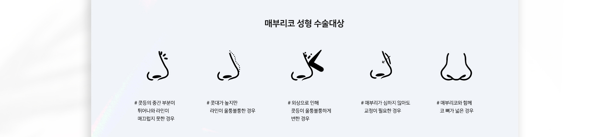 매부리코 성형 수술대상 # 콧등의 중간 부분이 튀어나와 라인이 매끄럽지 못한 경우 # 콧대가 높지만 라인이 울퉁불퉁한 경우 # 외상으로 인해 콧등이 울퉁불퉁하게 변한 경우 # 매부리가 심하지 않아도 교정이 필요한 경우 # 매부리코와 함께 코 뼈가 넓은 경우