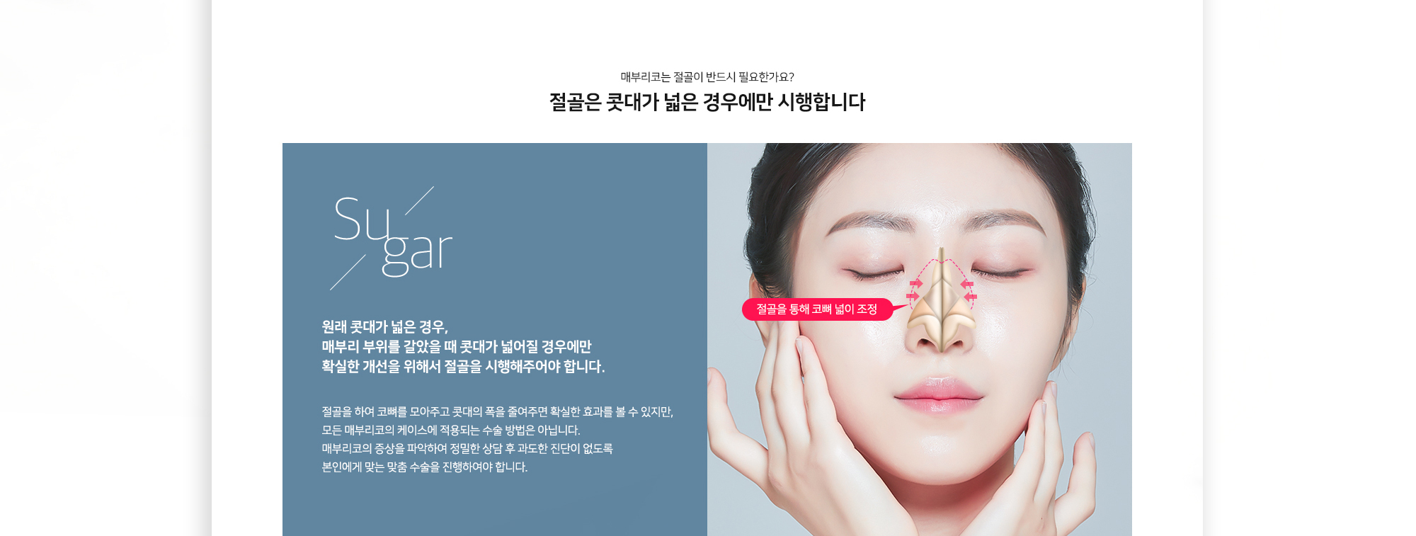 매부리코는 절골이 반드시 필요한가요? 절골은 콧대가 넓은 경우에만 시행합니다. 원래 콧대가 넓은 경우, 매부리 부위를 갈았을 때 콧대가 넓어질 경우에만 확실한 개선을 위해서 절골을 시행해주어야 합니다. 절골을 하여 코뼈를 모아주고 콧대의 폭을 줄여주면 확실한 효과를 볼 수 있지만, 모든 매부리코의 케이스에 적용되는 수술 방법은 아닙니다. 매부리코의 증상을 파악하여 정확한 상황 후 과도한 진단이 없도록 본인에게 맞는 맞춤 수술을 진행하여야 합니다. 절골을 통해 코뼈 넓이 조정.