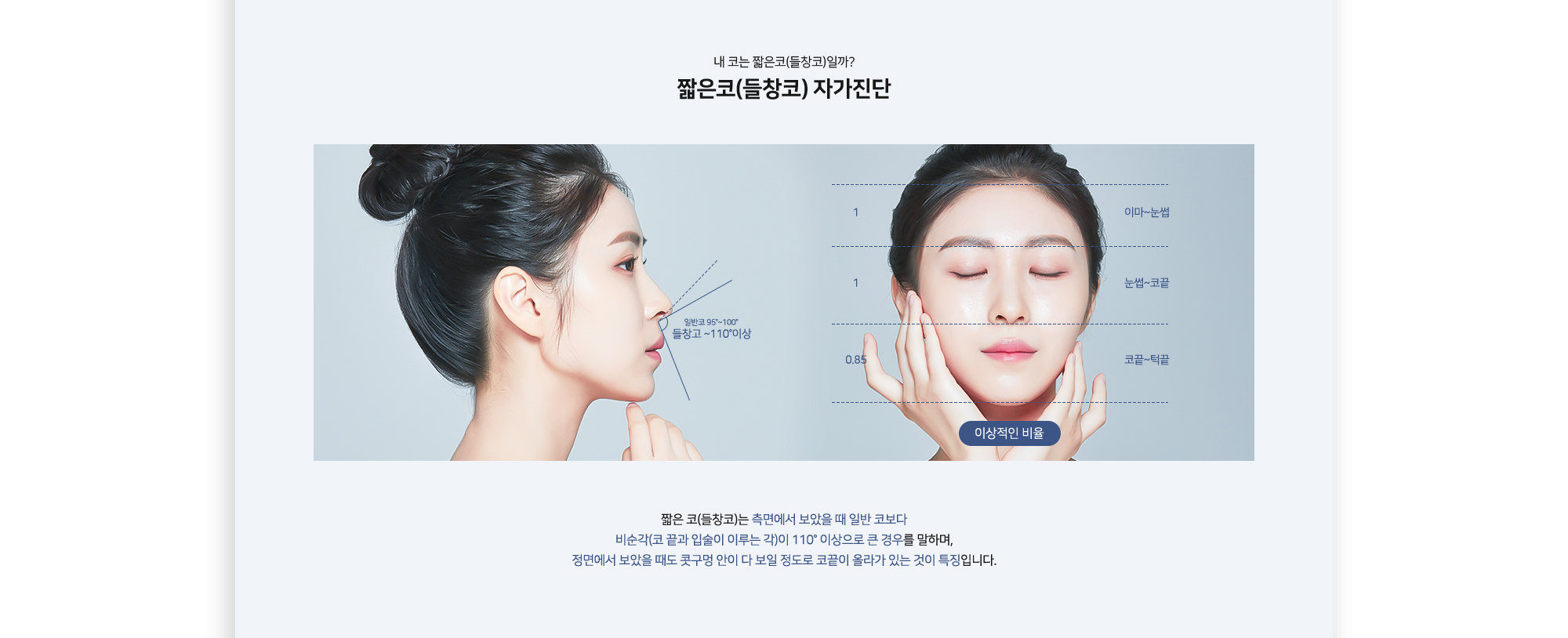 내 코는 짧은코(들창코)일까? 짧은코(들창코) 자가진단 일반코 95~100° 들창코 110° 이상 이상적인 비율 이마~눈썹, 눈썹~코끝, 코끝~턱끝 0.85 짧은 코(들창코)는 측면에서 보았을 때 일반 코보다 비순각(코 끝과 입술이 이루는 각)이 110° 이상으로 큰 경우를 말하며, 정면에서 보았을 때도 콧구멍 안이 다 보일 정도로 코끝이 올라가 있는 것이 특징입니다.