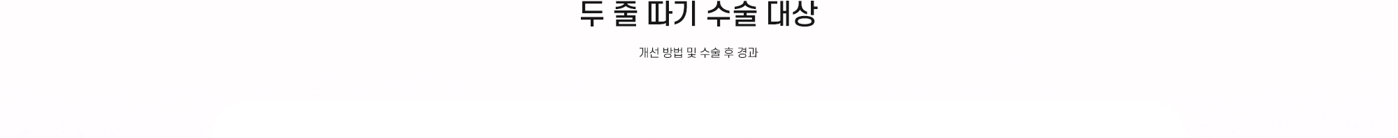 두 줄 따기 수술 대상 - 개선 방법 및 수술 후 경과