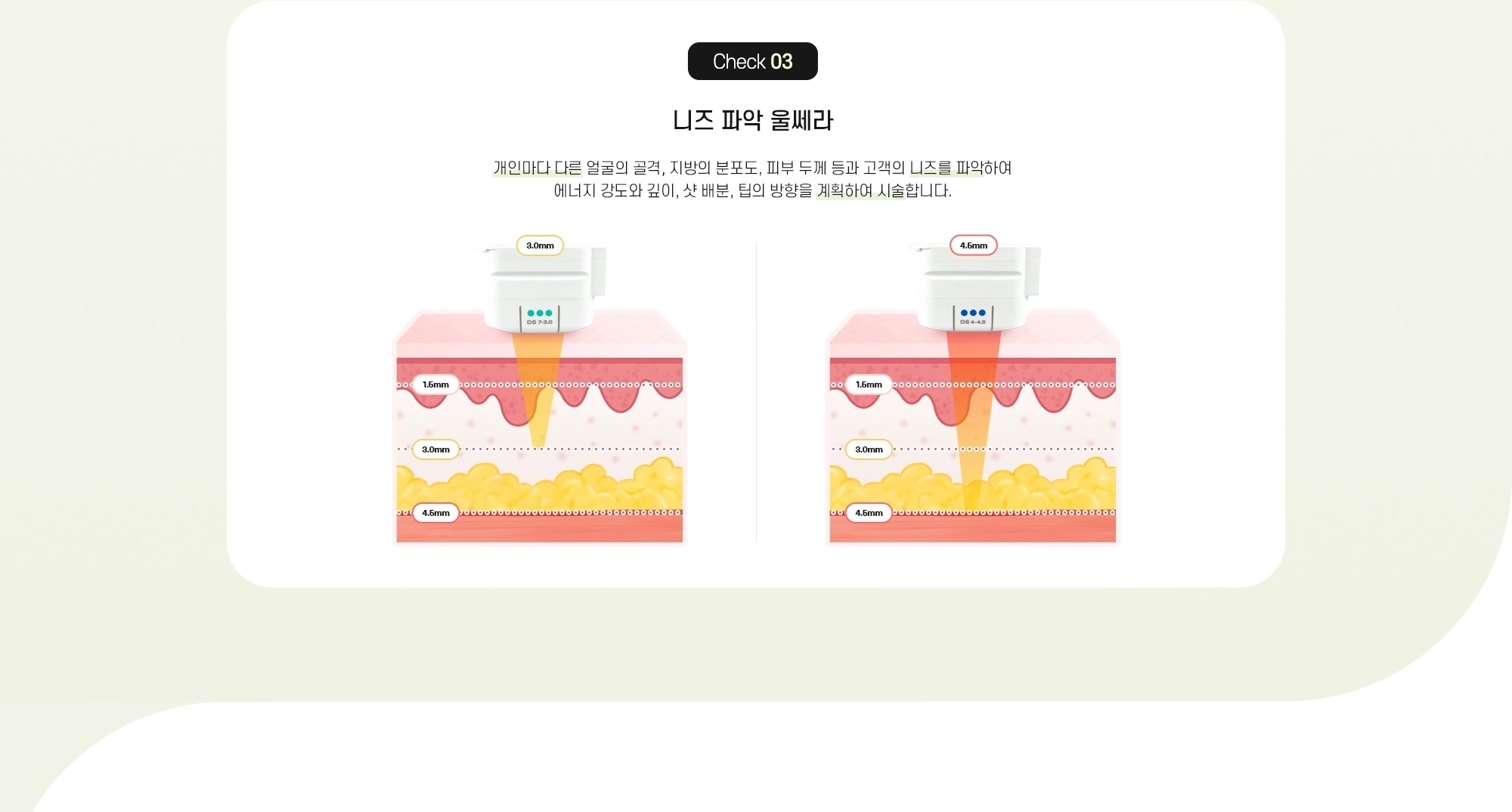 Check 03 니즈 파악 울쎄라 - 개인마다 다른 얼굴의 골격, 지방의 분포도, 피부 두께 등과 고객의 니즈를 파악하여 에너지 강도와 깊이, 샷 배분, 팁의 방향을 계획하여 시술합니다. (3.0mm DS 7-3.0 / 4.5mm DS 4-4.5 / 1.5mm, 3.0mm, 4.5mm 피부 깊이별 시술)