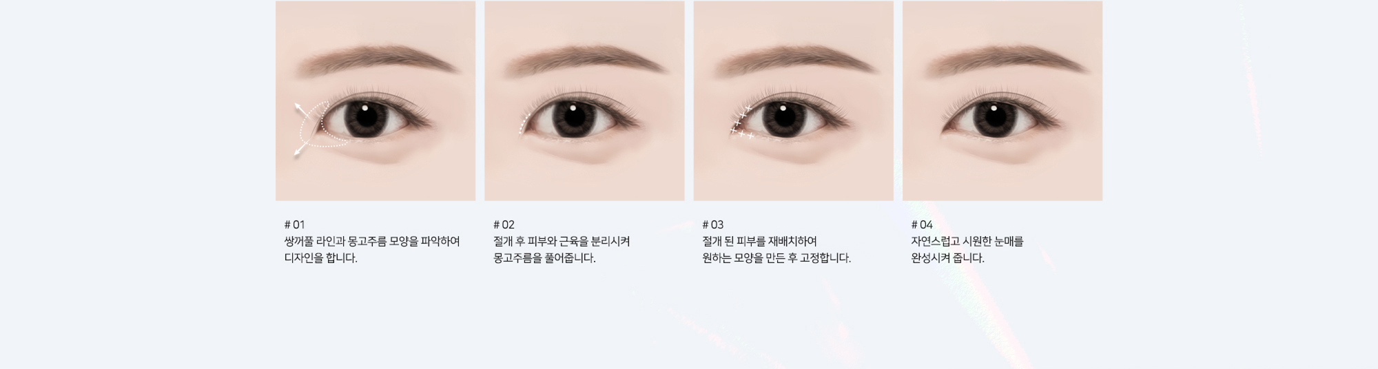 # 01 : 쌍꺼풀 라인과 몽고주름 모양을 파악하여 디자인을 합니다.   # 02 : 절개 후 피부와 근육을 분리시켜 몽고주름을 풀어줍니다.   # 03 : 절개 된 피부를 재배치하여 원하는 모양을 만든 후 고정합니다.   # 04 : 자연스럽고 시원한 눈매를 완성시켜 줍니다.