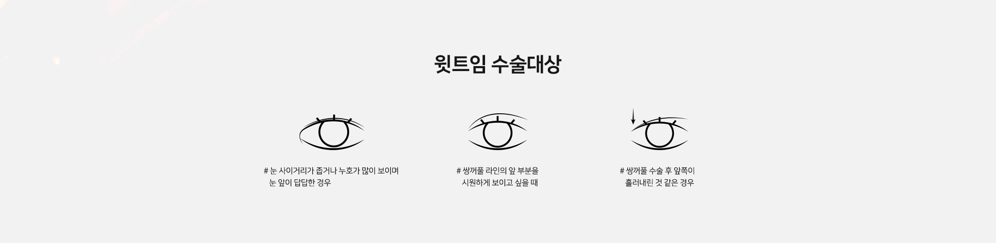 [윗트임 수술대상] # 눈 사이거리가 좁거나 누호가 많이 보이며 눈 앞이 답답한 경우   # 쌍꺼풀 라인의 앞 부분을 시원하게 보이고 싶을 때   # 쌍꺼풀 수술 후 앞쪽이 흘러내린 것 같은 경우