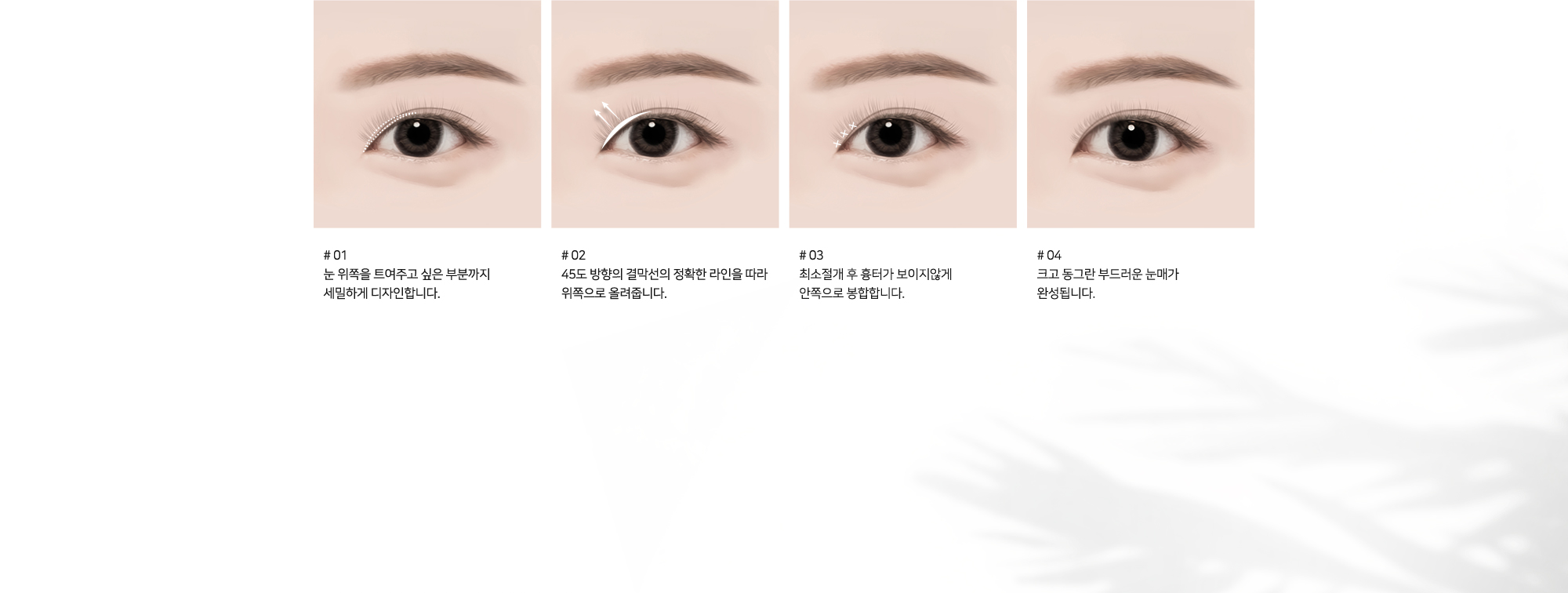 # 01 : 눈 위쪽을 트여주고 싶은 부분까지 세밀하게 디자인합니다.   # 02 : 45도 방향의 결막선의 정확한 라인을 따라 위쪽으로 올려줍니다.   # 03 : 최소절개 후 흉터가 보이지않게 안쪽으로 봉합합니다.   # 04 : 크고 동그란 부드러운 눈매가 완성됩니다.