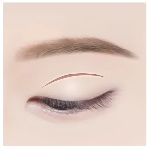 절개 쌍꺼풀 1단계 — 라인 절개