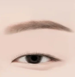 절개 눈매교정 1단계 — 눈매 디자인