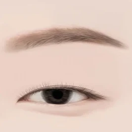 안검하수 단계 — 고도의 하수