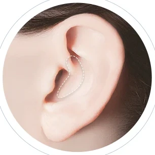 귀 연골과 비중격 연골 채취