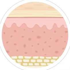 채취한 진피