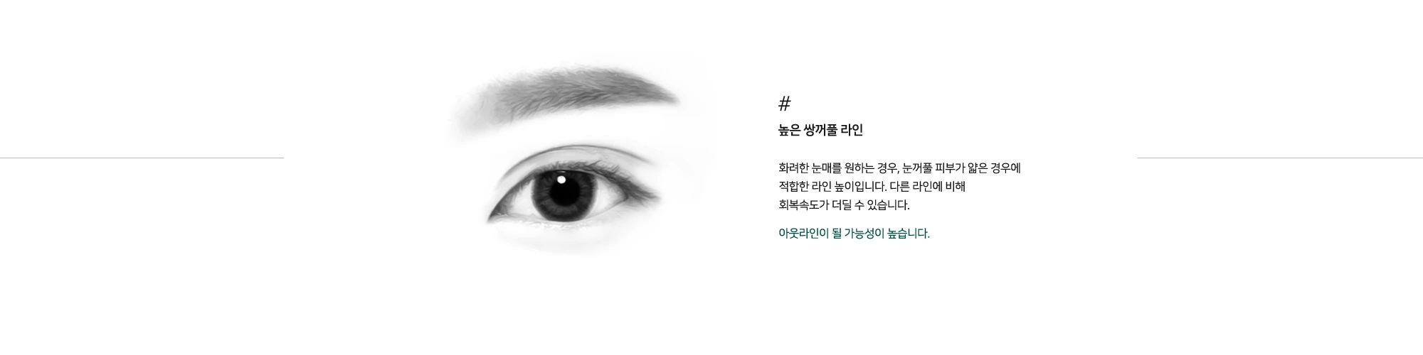 높은 쌍꺼풀 라인 높이 예시
